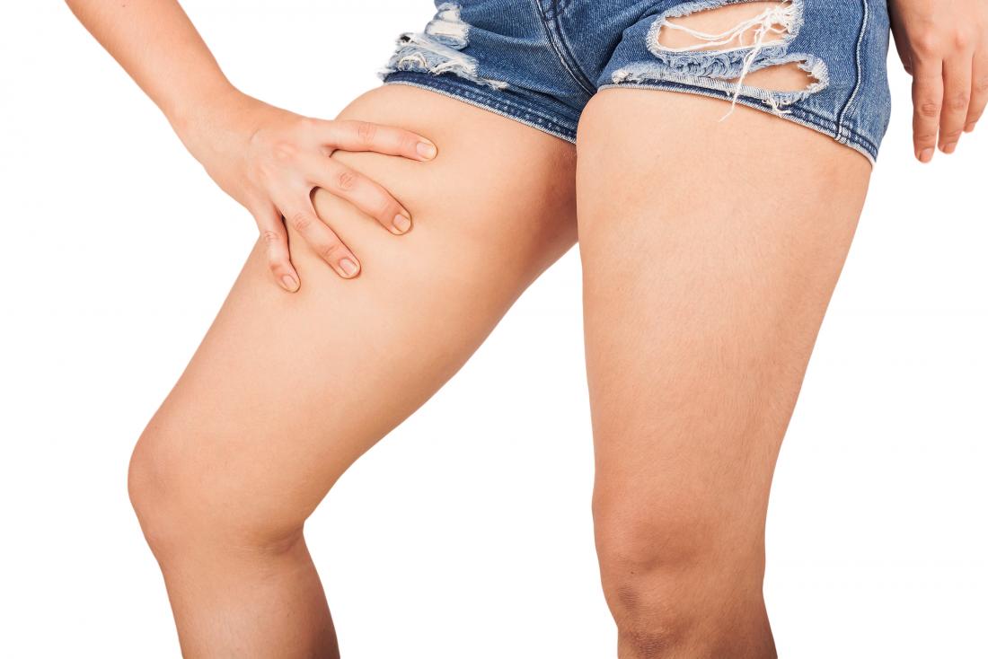 Can Chafing Cause Bumps? - No More Chafe - Thigh Guards
