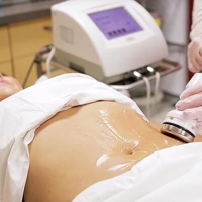 Can I Exercise On The Day Of My Ultrasound Cavitation Treatment?