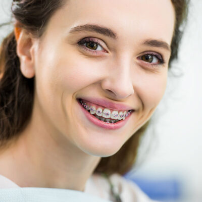 What do you mean by orthodontics for Adults?