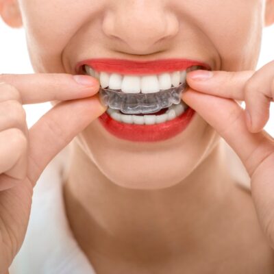 Why Should You Consider Invisalign Treatment