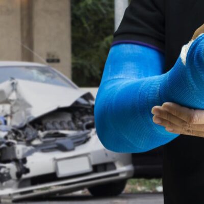 Treat Your Injuries Caused By A Car Accident